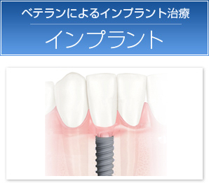 第二の永久歯／インプラント
